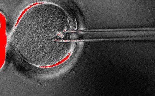In this undated photo provided by OHSU Center for Embryonic Cell and Gene Therapy, scientists use a pipette to remove the nucleus from an egg. Britain's fertility regulator has approved controversial techniques allowing doctors to create babies using DNA from three people — what it called a 