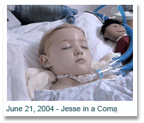 Jesse while in kimotherapy (www.jessekoochin.com)