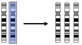There is an extra 18th Chromosome (Chromosome18.org)