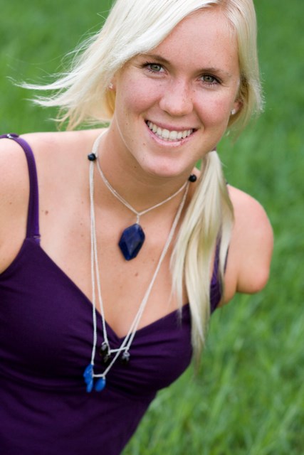This is Bethany Hamilton after the accident. ( ())