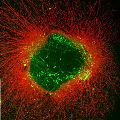 Picture of Axons Get a Kiss