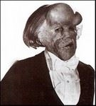 This is the photo that represents Elephant Man. (This picture is shown in the famous website 