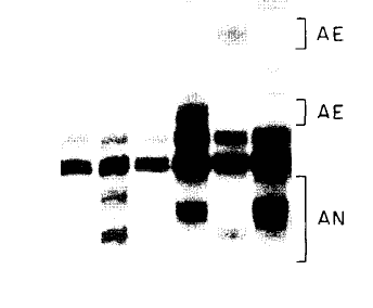 The Huntington's Disease gene (Cell, Vol. 72, 971-963. March 26, 1993,)