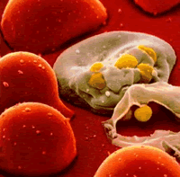 HIV infected blood cell (www.hivandhepatitis.com/recent/2008/121208_b.html)