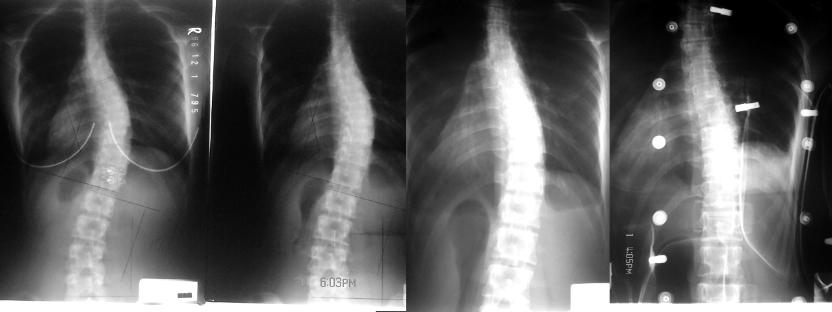 My vertebra (2007-2009) (myself)
