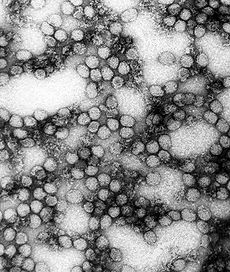 Yellow Fever Virus (http://en.wikipedia.org/wiki/Yellow_fever (A TEM Micrograph Image))