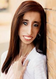 Die 35 Jahre alte 157 cm große Lizzie Velasquez im 2024 Foto