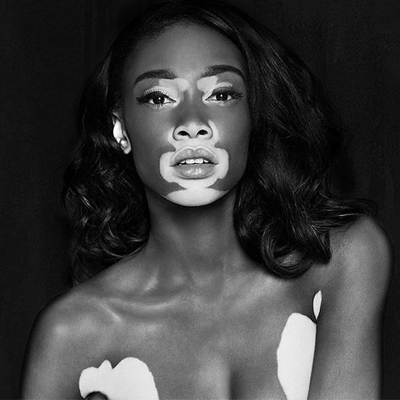 Chantelle Winnie poses once more for Desigual