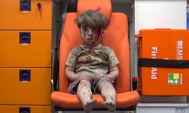 the syrian boy (http://edition.cnn.com/2016/08/20/middleeast/syria ())