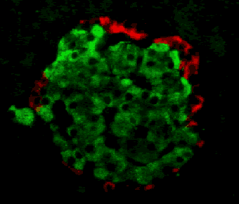 Magnified image of pancreatic islets, which contain insulin-producing beta cells.