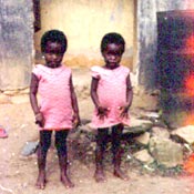 The innocent affectd by HIV/AIDS